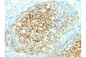 Formalin-fixed, paraffin-embedded human Tonsil stained with CD106 Monoclonal Antibody (1. (VCAM1 antibody)