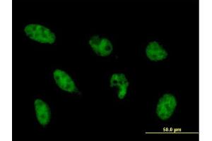 Immunofluorescence of monoclonal antibody to NFYB on HeLa cell. (NFYB antibody  (AA 1-207))