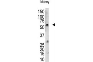 Western Blotting (WB) image for anti-RanBP-Type and C3HC4-Type Zinc Finger Containing 1 (RBCK1) antibody (ABIN3001446)