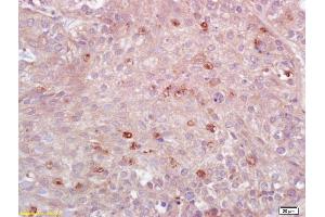 HLA-DPB1 antibody  (AA 101-210)