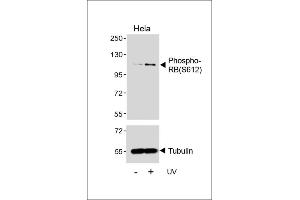 Western blot analysis of lysates from Hela cell line, untreated or treated with UV(2h), using Phospho-RB Antibody (upper) or Tubulin (lower). (Retinoblastoma 1 antibody  (pSer612))