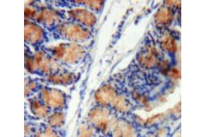 Used in DAB staining on fromalin fixed paraffin-embedded Intestine tissue (SERPINB1 antibody  (AA 13-252))