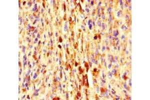 Exophilin 5 antibody  (AA 1235-1490)