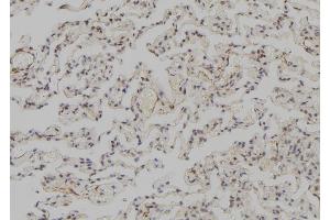 ABIN6273570 at 1/100 staining Human lung tissue by IHC-P. (SNAPC3 antibody  (C-Term))