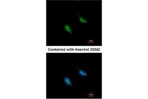 ICC/IF Image Immunofluorescence analysis of paraformaldehyde-fixed HeLa, using RFC3, antibody at 1:200 dilution. (RFC3 antibody)