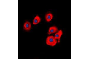 Immunofluorescent analysis of OLFML2B staining in HuvEc cells. (OLFML2B antibody  (Center))