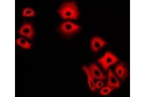 Immunofluorescent analysis of NCS1 staining in A549 cells. (NCS1 antibody)
