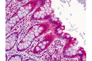Human Colon: Formalin-Fixed, Paraffin-Embedded (FFPE) (SLFN12 antibody  (C-Term))