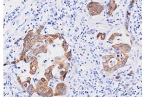 Immunohistochemistry (IHC) image for anti-Fas (TNFRSF6)-Associated Via Death Domain (FADD) (AA 1-208), (N-Term) antibody (ABIN317514)