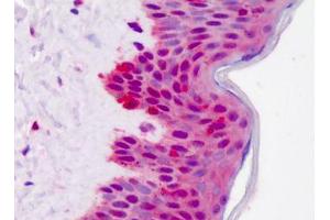 Human Skin: Formalin-Fixed, Paraffin-Embedded (FFPE) (YWHAB antibody  (AA 1-141))