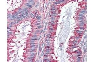 Immunohistochemistry (IHC) image for anti-G Protein-Coupled Receptor 27 (GPR27) (2nd Extracellular Domain) antibody (ABIN2470773) (GPR27 antibody  (2nd Extracellular Domain))