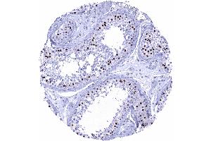 Testis Strong SOX9 staining of Sertoli cells (Recombinant SOX9 antibody  (AA 393-508))
