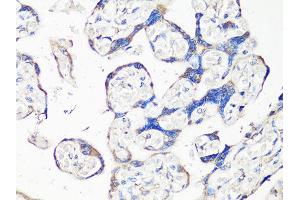 Immunohistochemistry of paraffin-embedded human placenta using MMP2 Antibody (ABIN4904395) at dilution of 1:100 (40x lens). (MMP2 antibody)