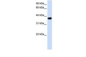 Image no. 1 for anti-Isoprenylcysteine Carboxyl Methyltransferase (ICMT) (AA 182-231) antibody (ABIN6738283) (ICMT antibody  (AA 182-231))