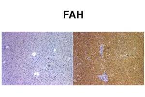 Sample Type: Human Liver and Mouse FAH KO liverPrimary Dilution: 1:400 (FAH antibody  (C-Term))
