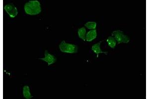 Immunofluorescent analysis of MCF-7 cells using ABIN7161170 at dilution of 1:100 and Alexa Fluor 488-congugated AffiniPure Goat Anti-Rabbit IgG(H+L) (SYNE2 antibody  (AA 1-176))