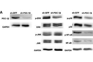 Peroxisome proliferator-activated receptor-gamma coactivator-1 β (PGC-1β) knockdown attenuates proinflammatory cytokines, matrix metalloproteinases (MMPs) and receptor activator of nuclear factor-kappa B ligand (RANKL) production in rheumatoid arthritis (RA)-fibrolast-like synoviocytes (FLS). (PPARGC1B antibody  (AA 901-1023))