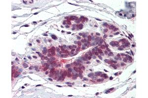 Anti-ELOVL5 antibody IHC of human breast.