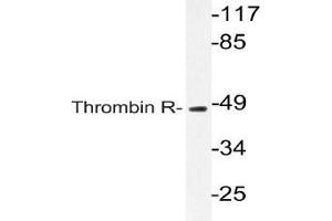 Western blot (WB) analyzes of Thrombin R antibody in extracts from Jurkat cells. (PAR1 antibody)