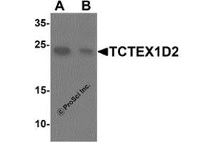 Western Blotting (WB) image for anti-Tctex1 Domain Containing 2 (TCTEX1D2) (N-Term) antibody (ABIN1587948) (TCTEX1D2 antibody  (N-Term))