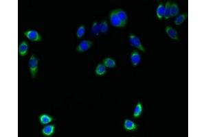 Immunofluorescent analysis of PC-3 cells using ABIN7173083 at dilution of 1:100 and Alexa Fluor 488-congugated AffiniPure Goat Anti-Rabbit IgG(H+L) (TMEM161A antibody  (AA 29-98))