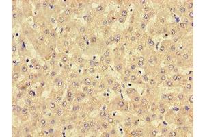 LPCAT3 antibody  (AA 306-363)
