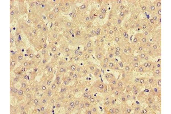 LPCAT3 antibody  (AA 306-363)