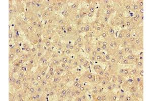Immunohistochemistry of paraffin-embedded human liver tissue using ABIN7158760 at dilution of 1:100 (LPCAT3 antibody  (AA 306-363))