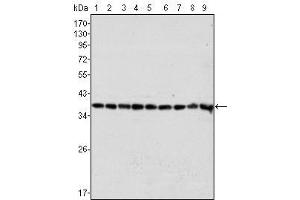 Western Blot showing GAPDH antibody used against Hela (1), A549 (2), A431 (3), MCF-7 (4), K562 (5), Jurkat (6), HL60 (7), SKN-SH (8) and SKBR-3 (9) cell lysate. (GAPDH antibody)