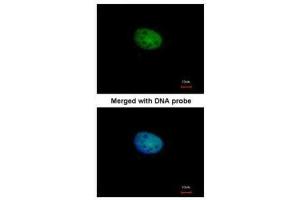 ICC/IF Image Immunofluorescence analysis of paraformaldehyde-fixed HeLa, using RBP-Jkappa, antibody at 1:100 dilution. (RBPJ antibody)