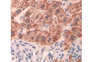 #VALUE! (BDH1 antibody  (AA 1-343))