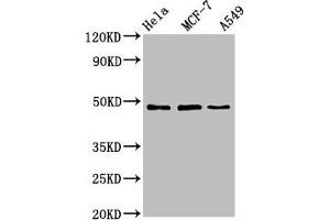 Western Blot Positive WB detected in: Hela whole cell lysate, MCF-7 whole cell lysate, A549 whole cell lysate All lanes: LCOR antibody at 4. (Lcor antibody  (AA 13-144))