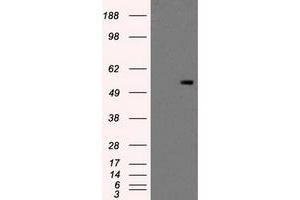 Image no. 2 for anti-Protein Kinase, Membrane Associated tyrosine/threonine 1 (PKMYT1) antibody (ABIN1500252)