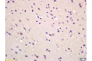 Formalin-fixed and paraffin embedded rat brain labeled with Anti-MAS1L Polyclonal Antibody, Unconjugated (ABIN759926) at 1:200 followed by conjugation to the secondary antibody and DAB staining. (MAS1L antibody  (AA 201-300))
