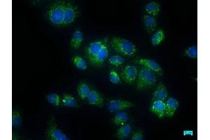 Immunofluorescence staining of Hela cells with ABIN7146911 at 1:50, counter-stained with DAPI. (CARD16 antibody  (AA 1-197))