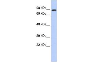 WB Suggested Anti-ZFYVE20 Antibody Titration:  0. (Rabenosyn 5 antibody  (N-Term))