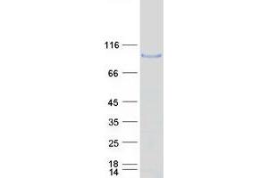 Validation with Western Blot (ADAM32 Protein (Myc-DYKDDDDK Tag))