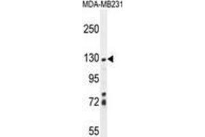 ZSWIM6 Antibody (C-term) western blot analysis in MDA-MB231 cell line lysates (35 µg/lane). (ZSWIM6 antibody  (C-Term))