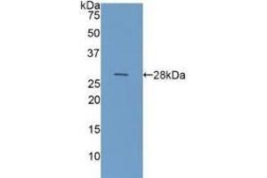 Detection of Recombinant GAL3, Human using Polyclonal Antibody to Galectin 3 (GAL3) (Galectin 3 antibody  (AA 1-250))