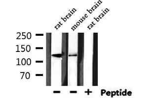 Western blot analysis of extracts from rat brain, mouse brain, using HDAC5 Antibody. (HDAC5 antibody  (C-Term))