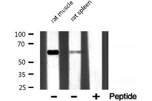 Western blot analysis of P62/SQSTM1 expression in various lysates (SQSTM1 antibody  (C-Term))