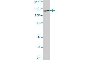 PDGFRB monoclonal antibody (M08), clone 4C12. (PDGFRB antibody  (AA 33-133))