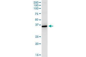 HSD11B1 monoclonal antibody (M02A), clone 2C10. (HSD11B1 antibody  (AA 1-292))