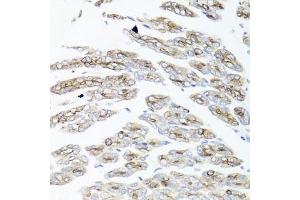 Immunohistochemistry of paraffin-embedded mouse stomach using IER3 antibody (ABIN6134174, ABIN6142158, ABIN6142159 and ABIN6224665) at dilution of 1:100 (40x lens). (IER3 antibody  (C-Term))