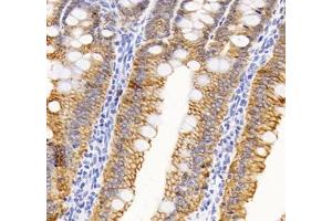 Immunohistochemistry of paraffin embedded rat small intestine using ATP1A1 (ABIN7073154) at dilution of 1: 500 (400x lens) (ATPase (Na/K) antibody)