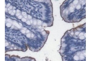 Detection of LPS in Rat Colon Tissue using Monoclonal Antibody to Lipopolysaccharide (LPS) (Lipopolysaccharides (LPS) antibody)