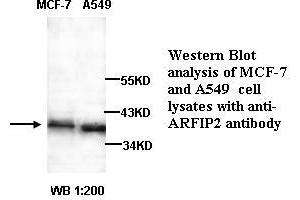 Image no. 1 for anti-ADP-Ribosylation Factor Interacting Protein 2 (ARFIP2) antibody (ABIN790882) (ARFIP2 antibody)