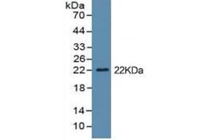 Rabbit Capture antibody from the kit in WB with Positive Control: Cell culture supernatant and 293F cell lysate which transfected with mouse IL1b gene. (IL-1 beta ELISA Kit)