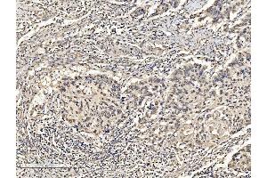 IHC analysis of KHSRP using anti-KHSRP antibody (ABIN7599776).