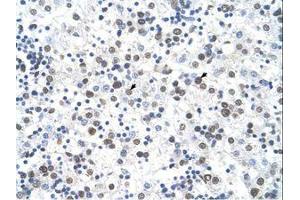 Image no. 1 for anti-Ferrochelatase (FECH) (AA 51-100) antibody (ABIN6736623) (FECH antibody  (AA 51-100))